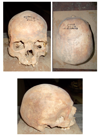 Мужской череп из погребения № 13 кургана № 3  могильника Кирилены (Молдова)